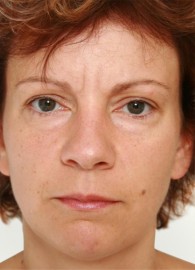 viksraitis